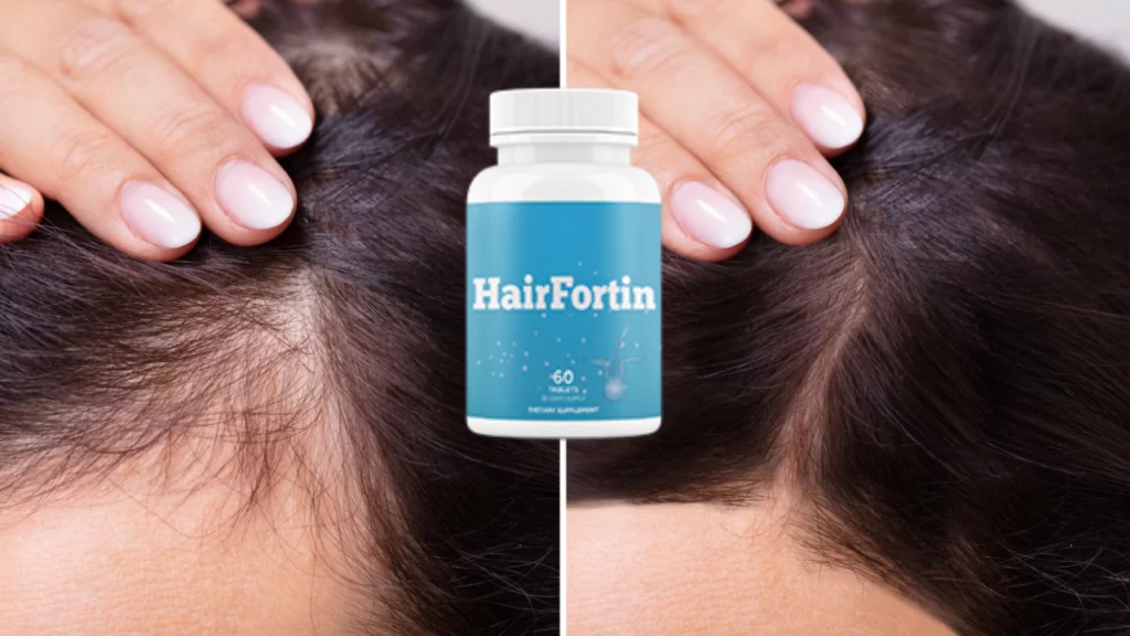 HairFortin Review: Unlocking the Secrets of Healthy Hair