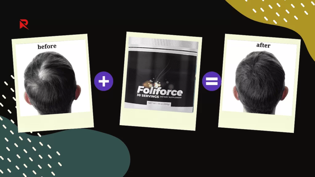 FoliForce Before And After