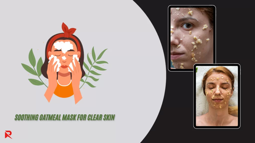 Top 10 Home Remedies for Acne | Effective Natural Treatments