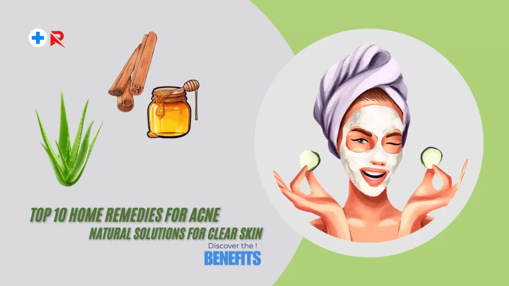 Top 10 Home Remedies for Acne with natural ingredients like aloe vera, honey, and oatmeal.